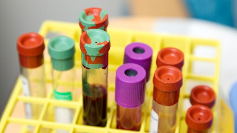 A photo of typical blood sample tubes